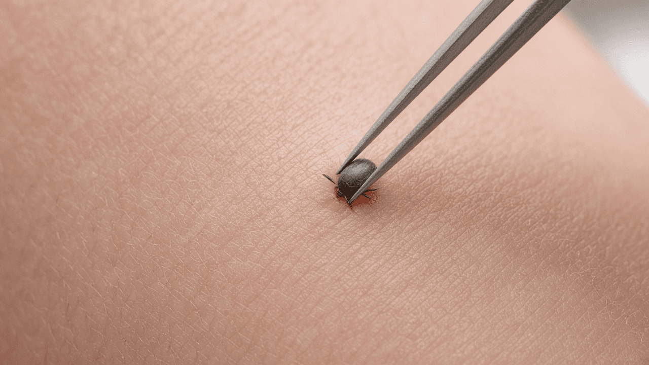 Fine-tipped tweezers grasping a tick close to skin on a forearm outdoors
